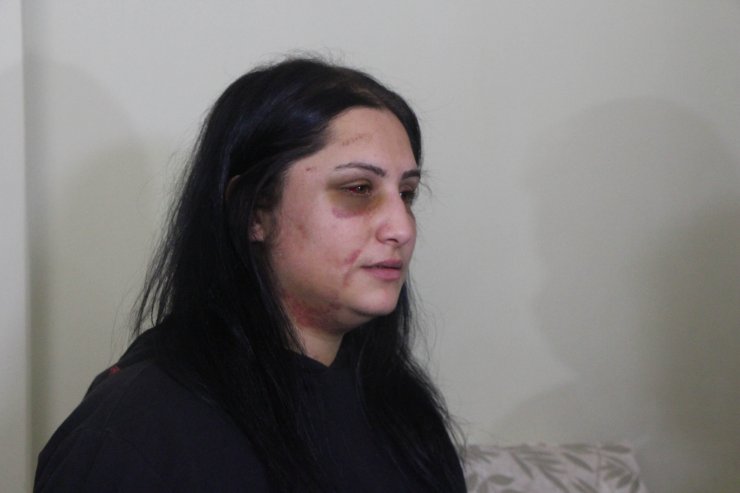 Boşandığı eşini sokak ortasında döven Zarap’ın 18 yıl hapsi isteniyor