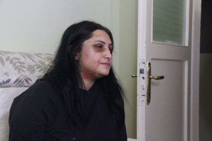 Boşandığı eşini sokak ortasında döven Zarap’ın 18 yıl hapsi isteniyor