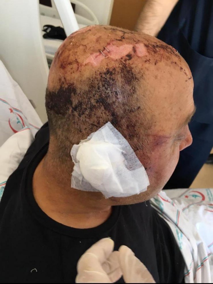 Telsizle dövülen polis memuru: Gözlerimi hastanede açtım