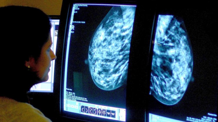 İngiltere’de meme kanseri tedavisinde kullanılan 'Phesgo'ya' onay