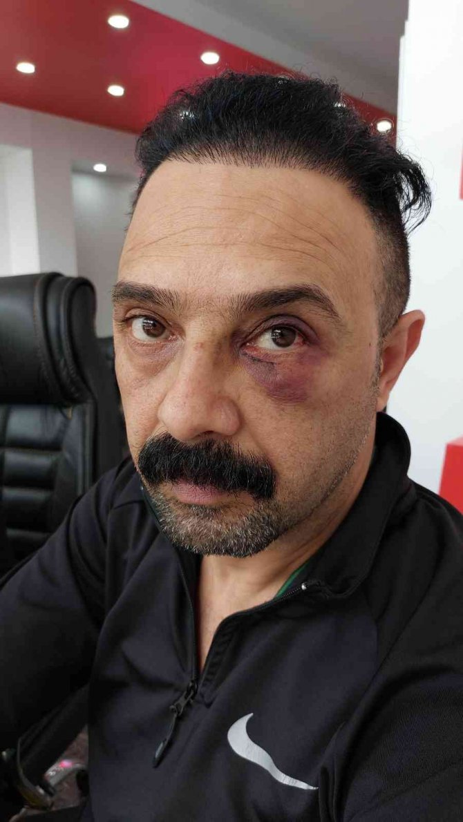 Iraklı şahsa iş yerinde yumruklu saldırı