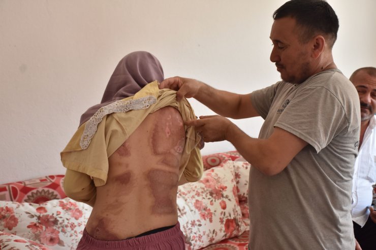 Yangında balkondan atlayınca komşunun kurtardığı kadın: Hayatımı borçluyum