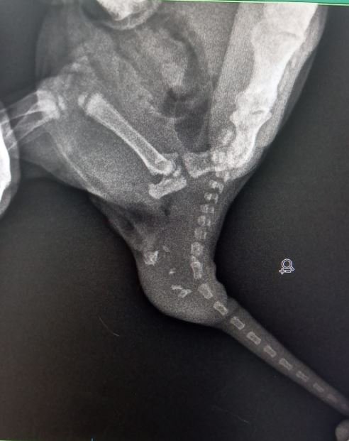 Dünyada bilinen ikinci vaka Türkiye'de yaşandı!