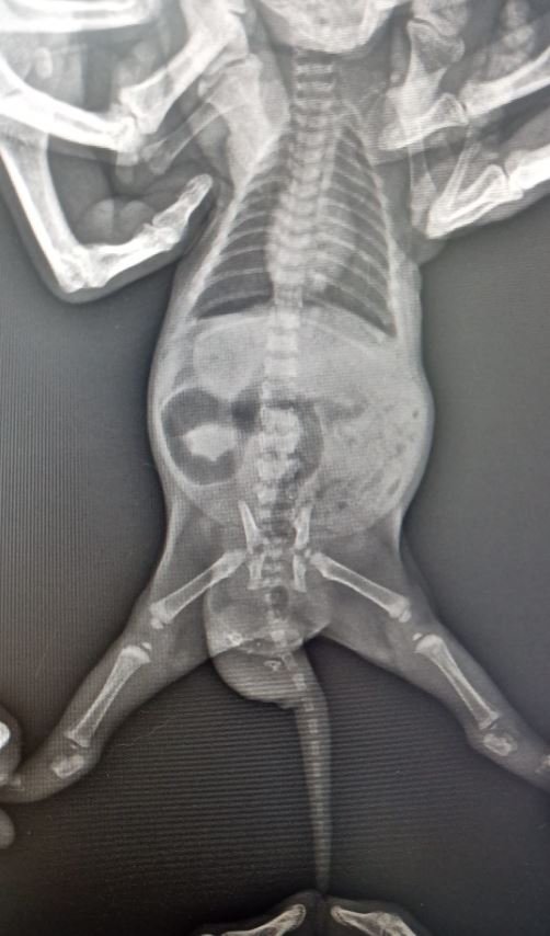 Dünyada bilinen ikinci vaka Türkiye'de yaşandı!