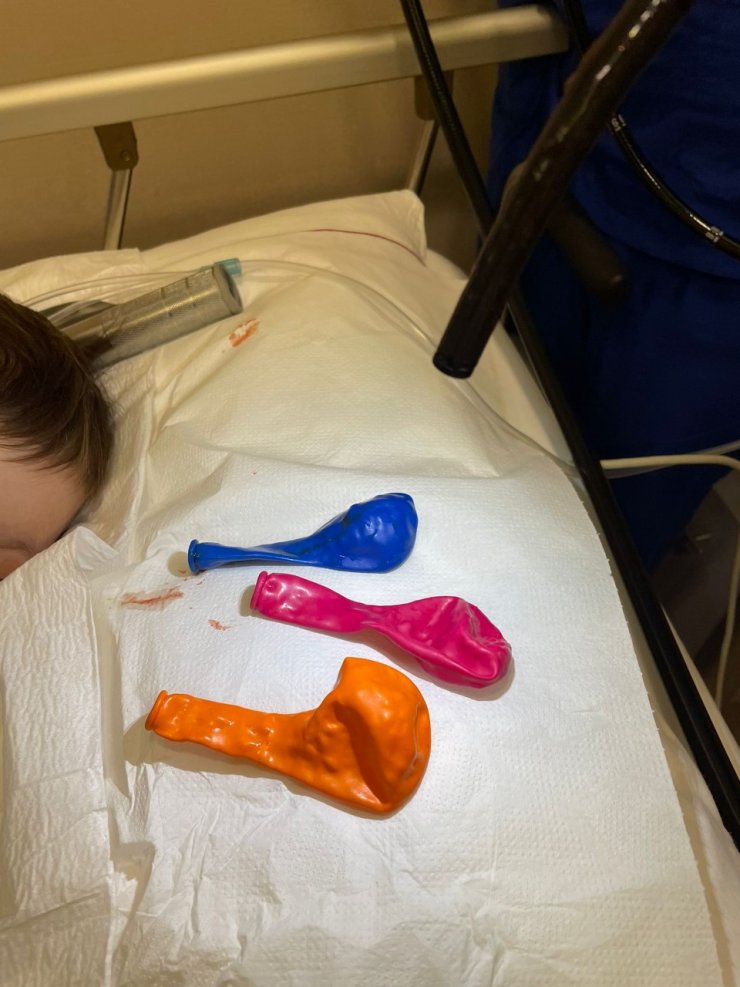 1 yaşındaki bebeğin midesinden çıkanlar hayrete düşürdü