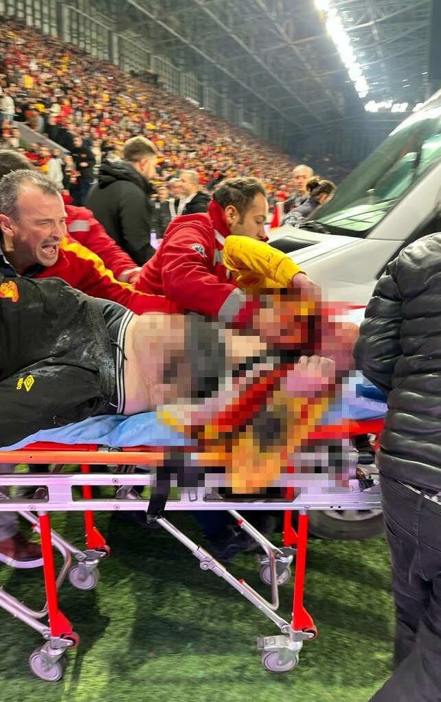 İşte Göztepeli taraftarı ağır yaralayan işaret fişeği