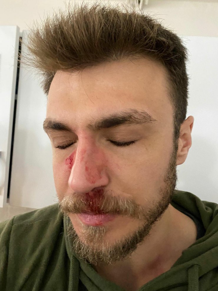 Darbedilen doktor kafa travması geçirmiş