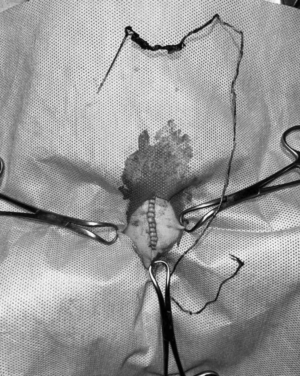 Kedinin midesinden çıktı