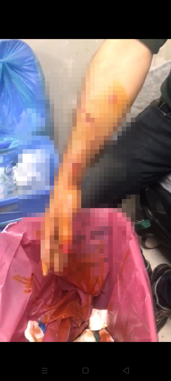 Sayaç okumaya giden çalışana köpek saldırdı