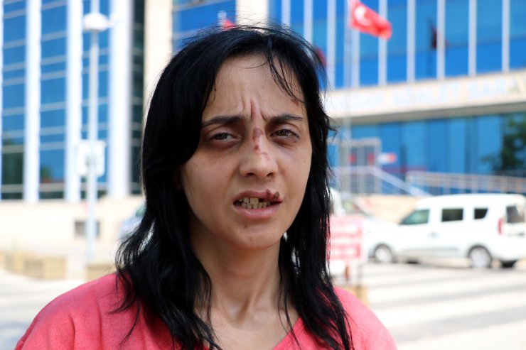 Gamze’yi yumruklayan saldırgan için hapis istemi