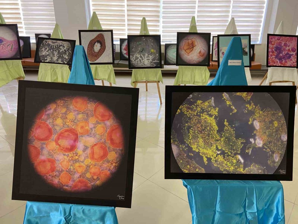 Konya Numune Hastanesi Tıbbi Patoloji Uzmanı hastalıklı dokuları sanat eserine dönüştürdü