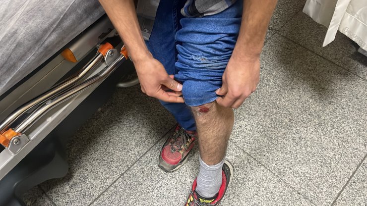 Otobüs beklerken köpeklerin saldırısına uğradı