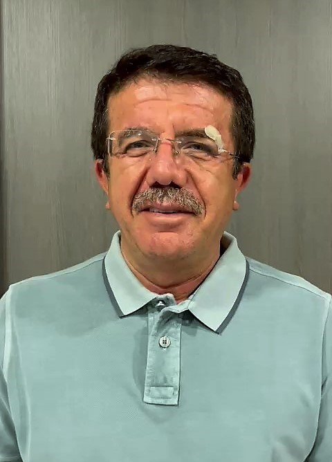 Kazada yaralanan eski Bakan Zeybekci: "Şu anda gayet iyi durumdayız"