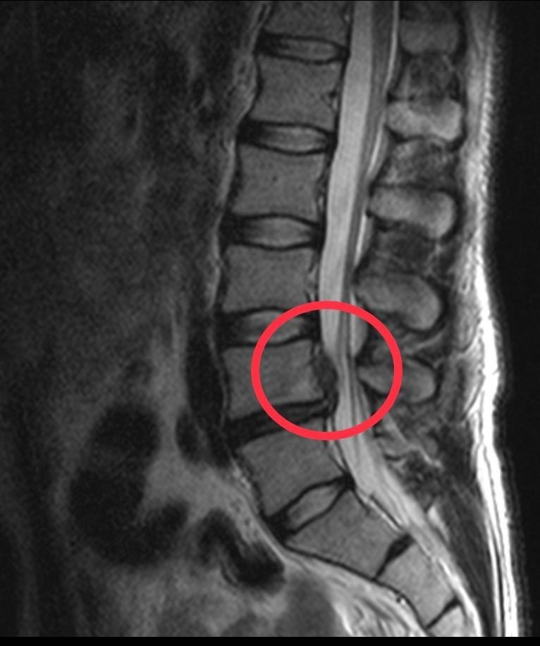 İskoçya'dan geldi şifayı Türkiye’de buldu