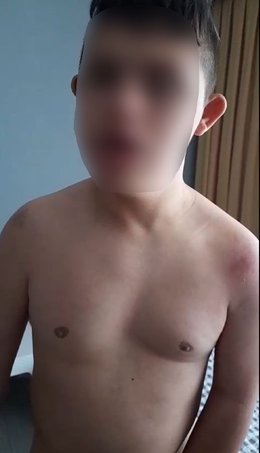 Down sendromlu çocuk öğretmeni tarafından darp edildi