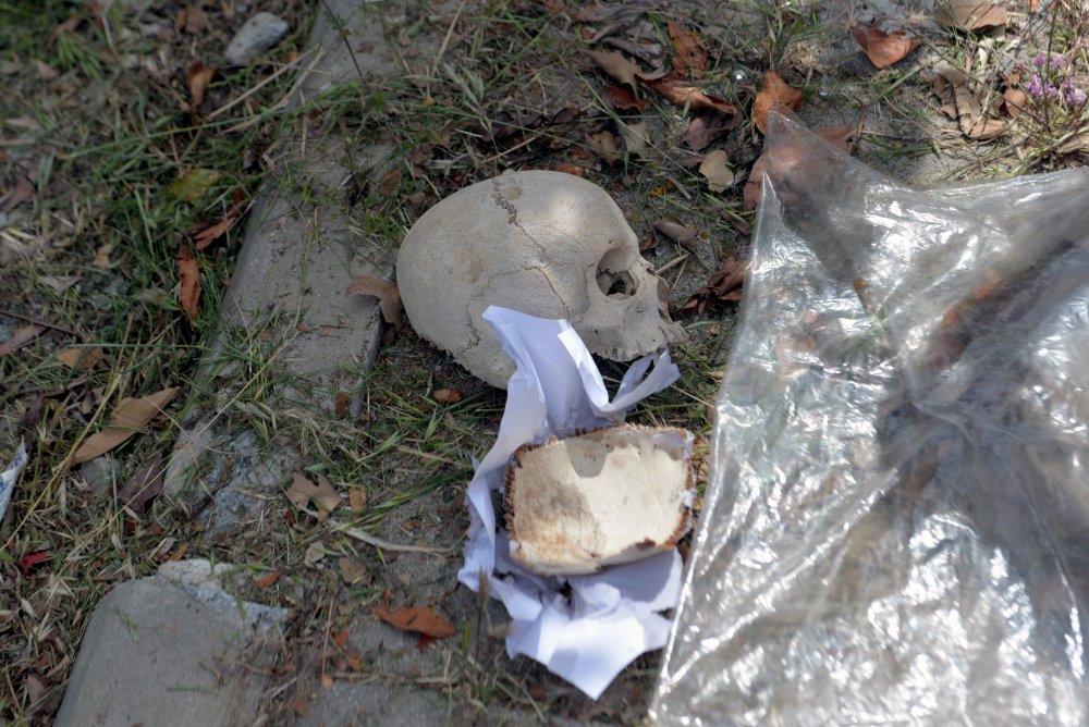 Çöpte bulunan kafatasının sırrı çözüldü