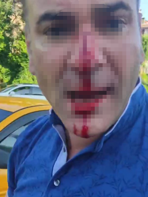 Baba- oğul, sürücüyü darbetti