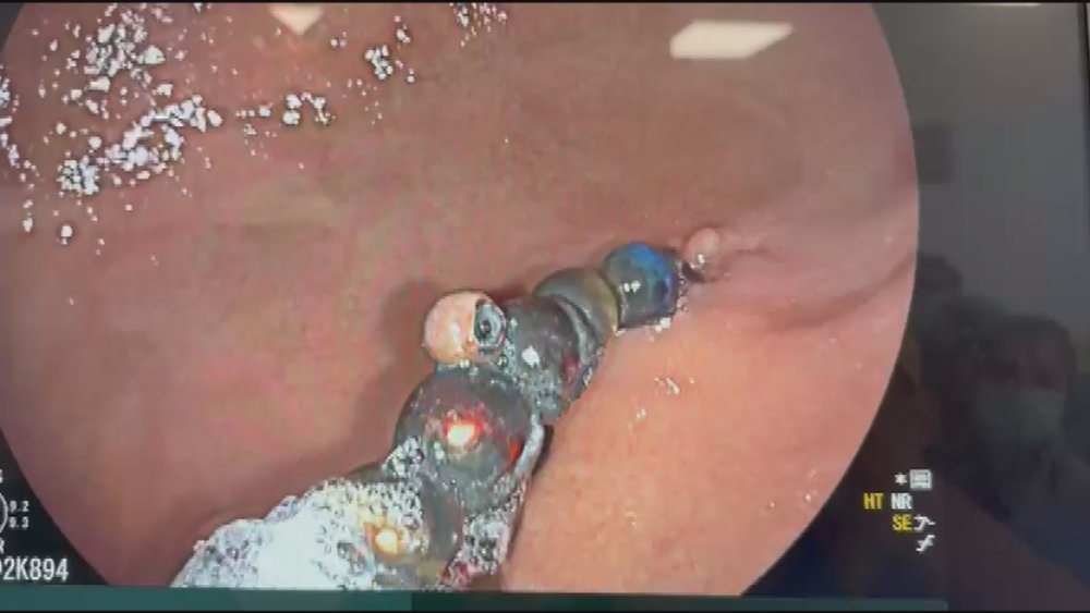 Doktorları bile şoke eden vaka!