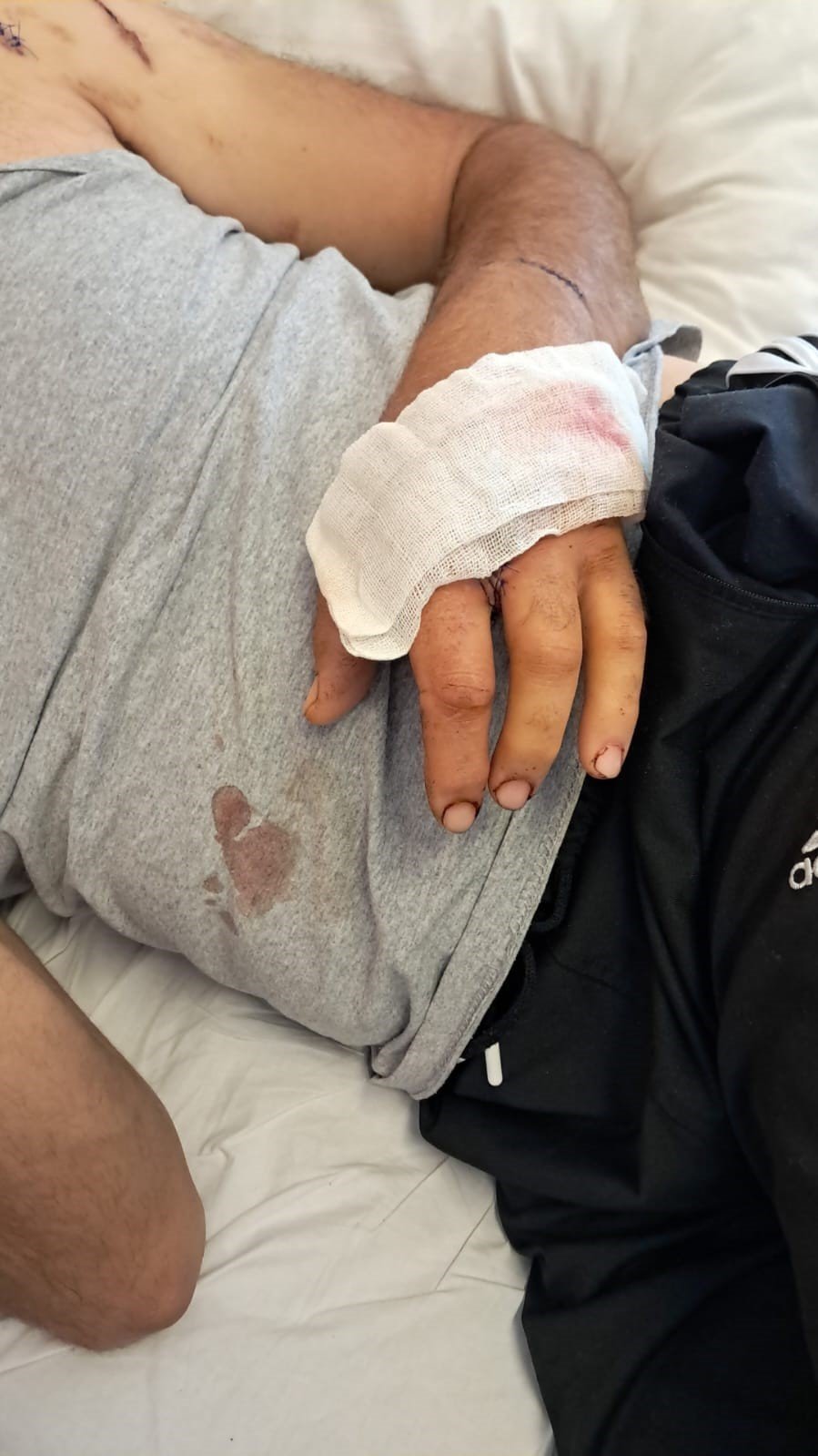 Ayının saldırısına uğrayan çiftçi dehşet anlarını anlattı