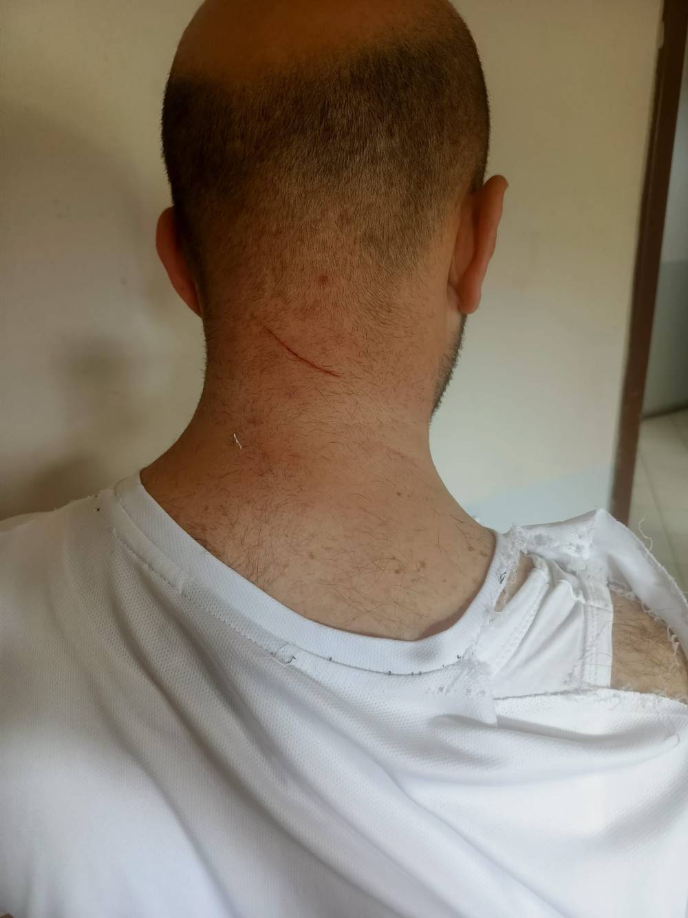 Kadınlardan sopalı saldırı