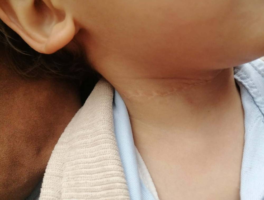 1,5 yaşındaki çocuğun boynunu kesti, ardından evini ateşe verdi