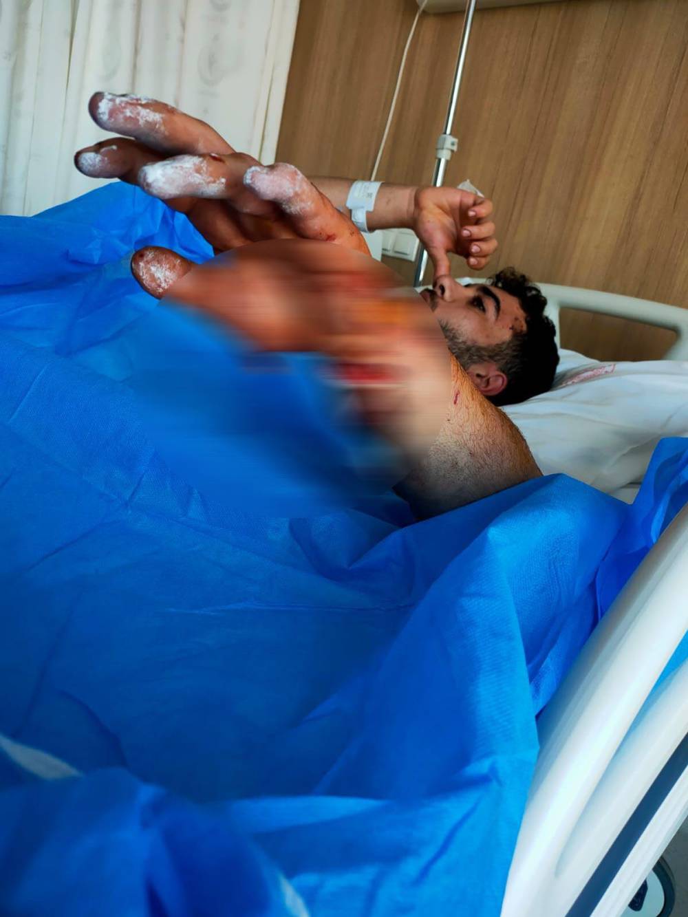 Çalıştığı iş yerinde besledikleri köpeğin saldırısına uğradı